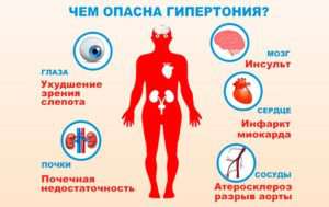 авиценна медикал медицинский центр николаев чем опасна гипертония