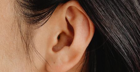 otoplastyka-operaz-avicenna-medical